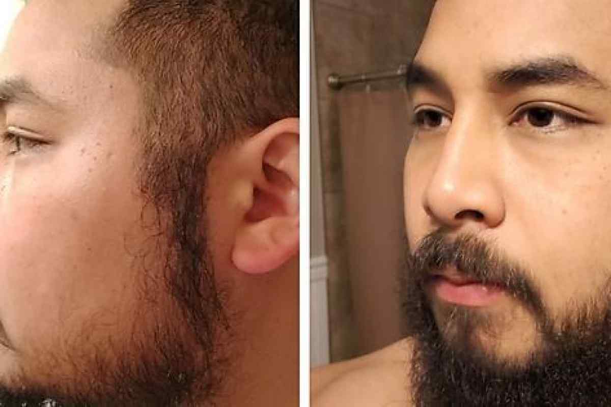 Як збільшити зростання бороди