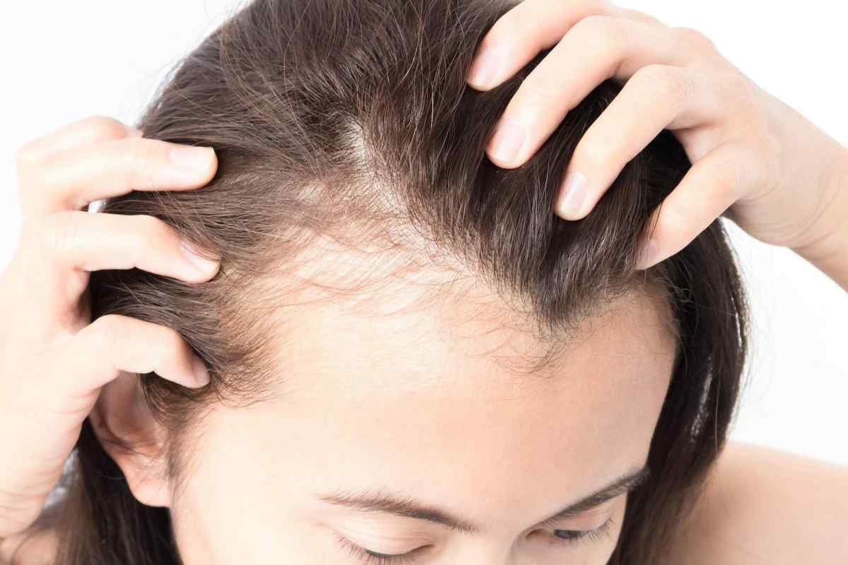 Як відновити волосся після випадання
