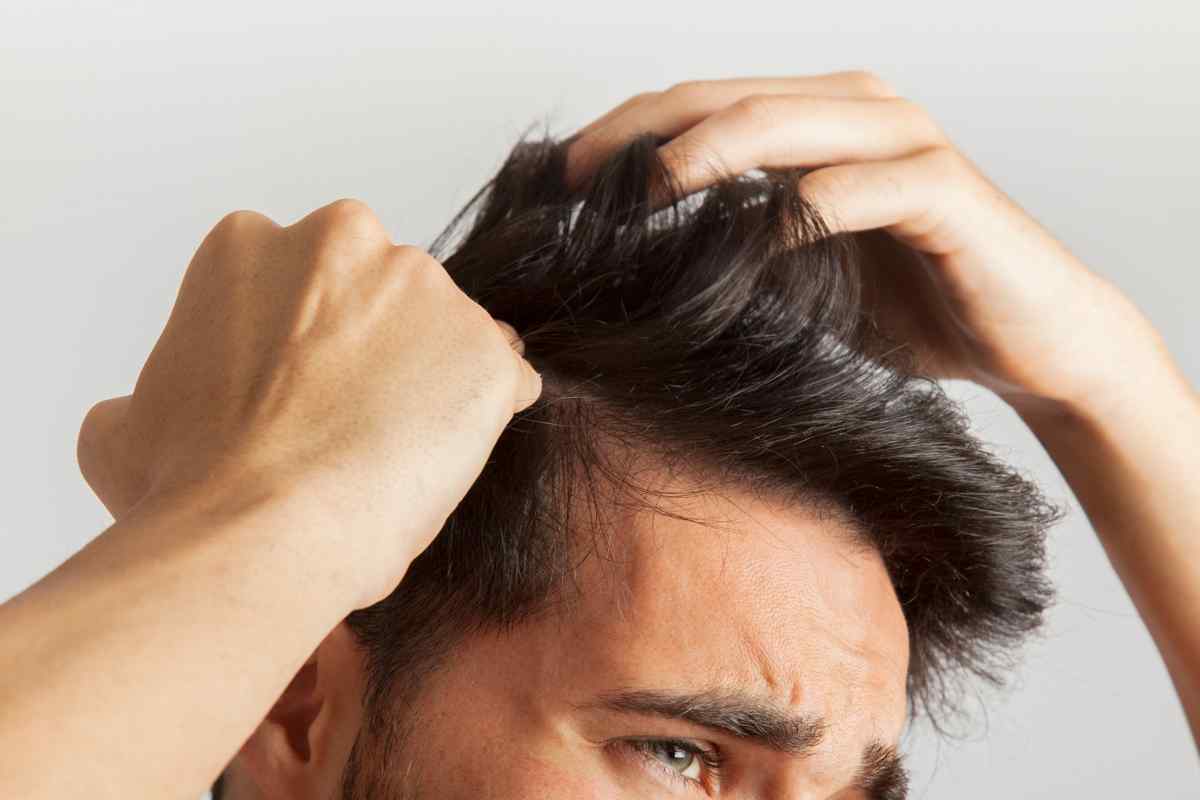 Як зупинити випадання волосся у чоловіків