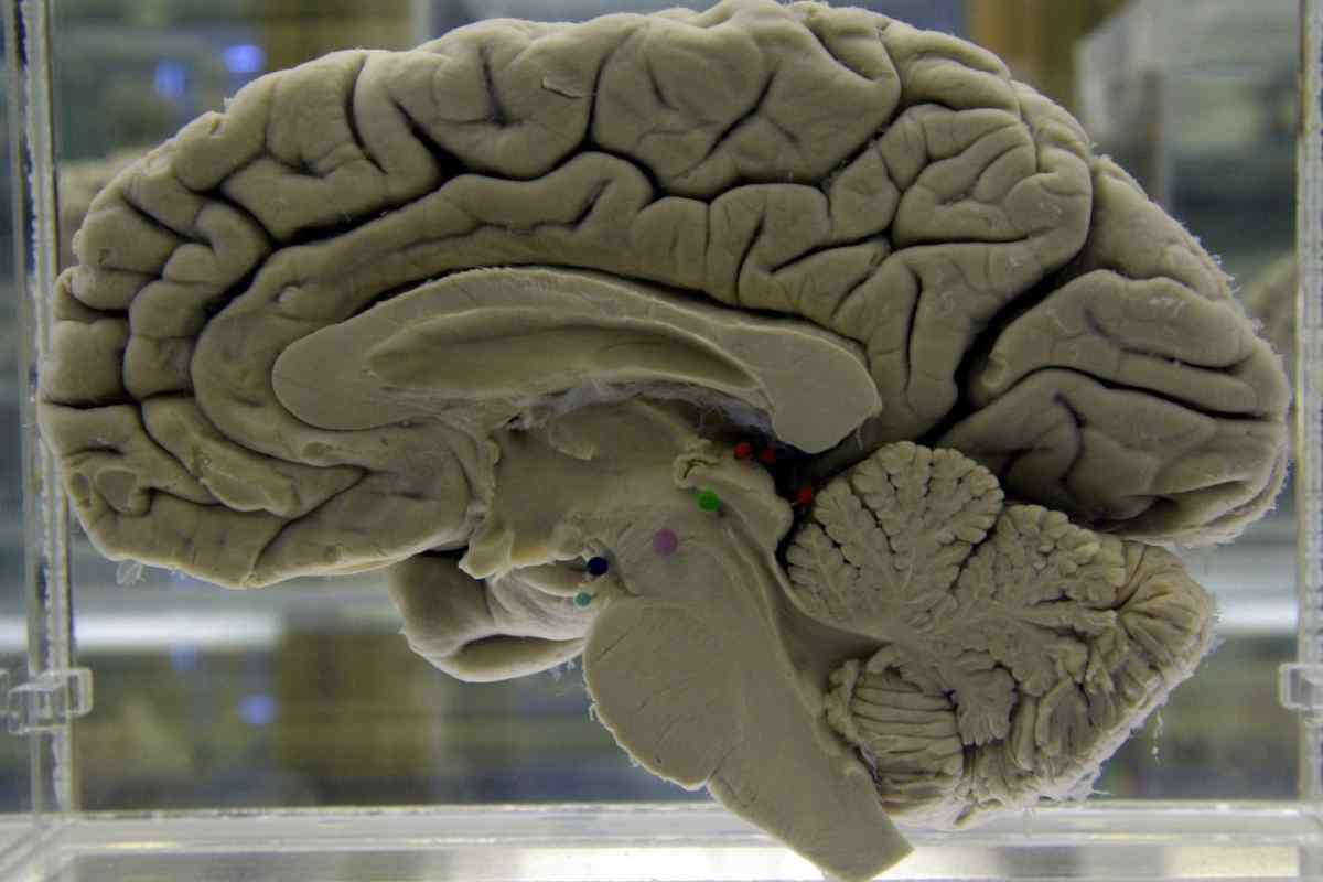 Чим відрізняється мозок чоловіка від мозку жінки