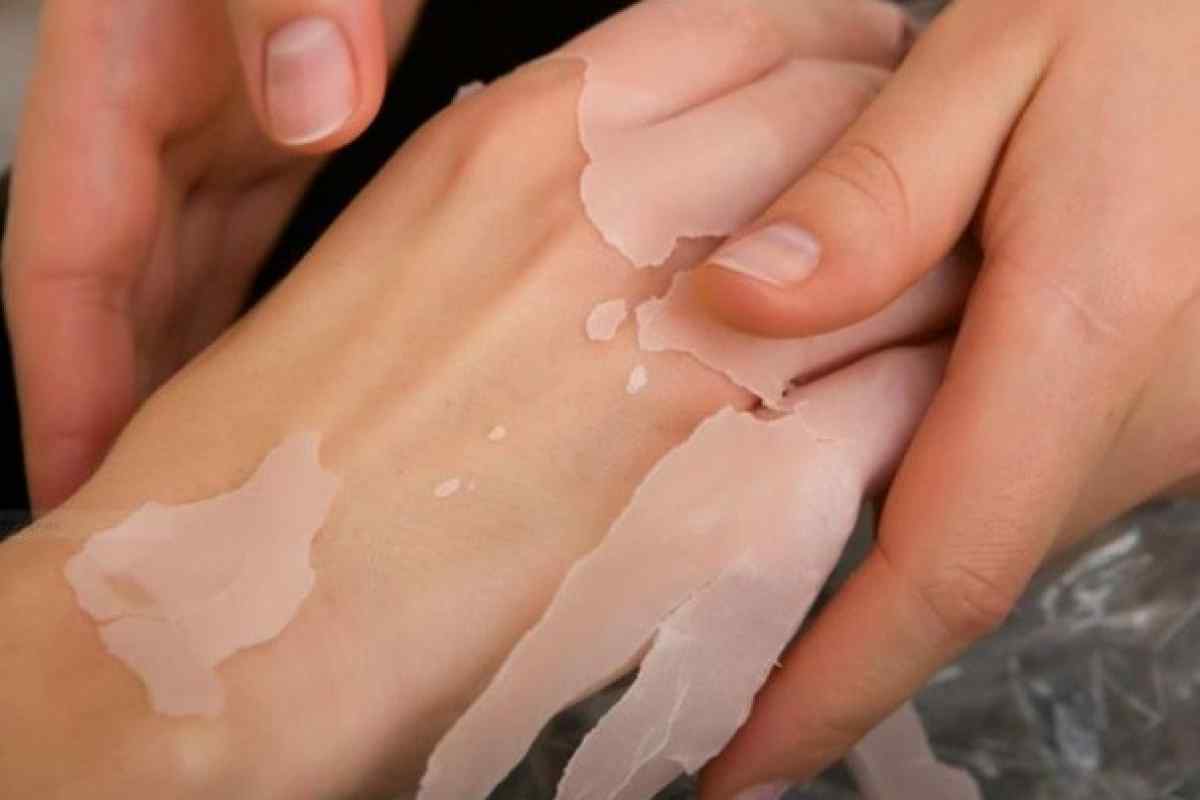 Як відбілити шкіру рук