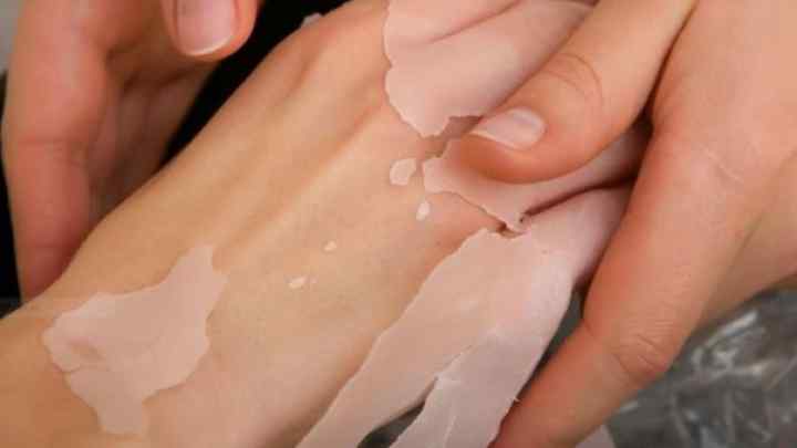 Як відбілити шкіру рук