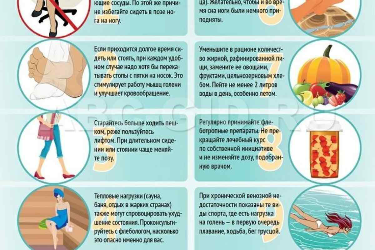 7 правил для профілактики варикозного розширення вен
