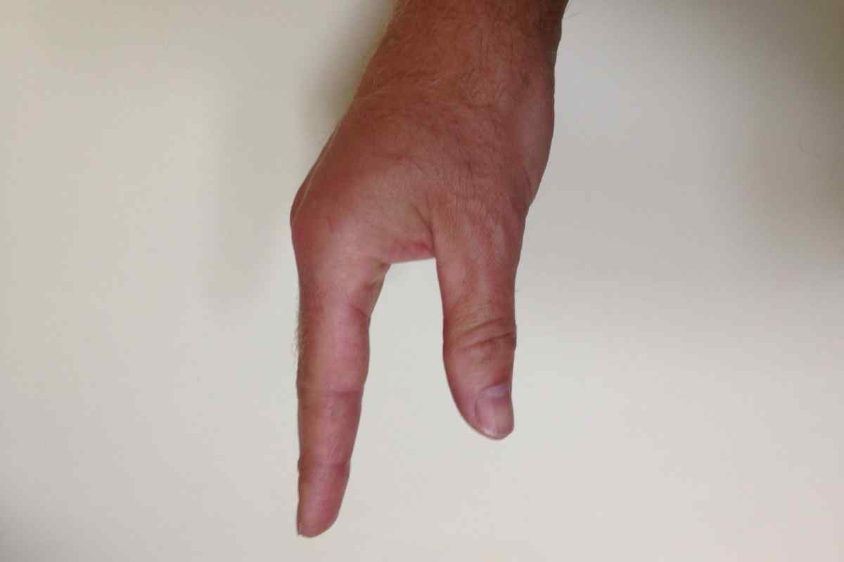 Рука с согнутым большим пальцем