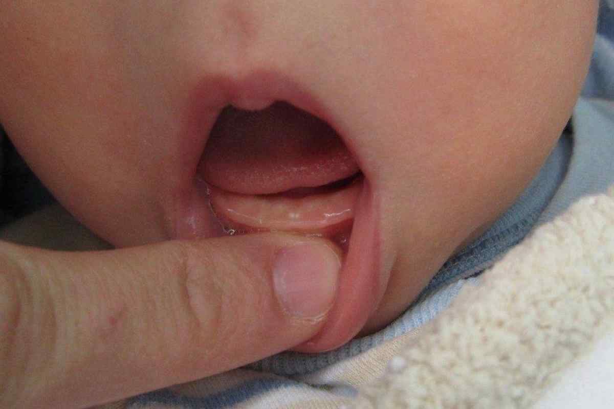 Чим допомогти дитині, коли ріжуться зуби