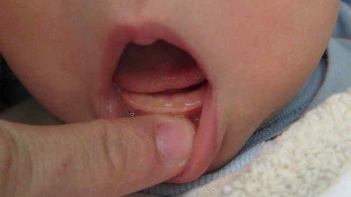 Чим допомогти дитині, коли ріжуться зуби
