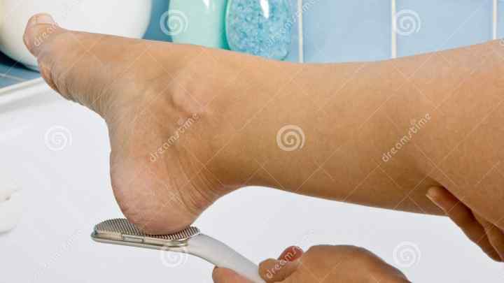 Як позбутися шрамів на ногах