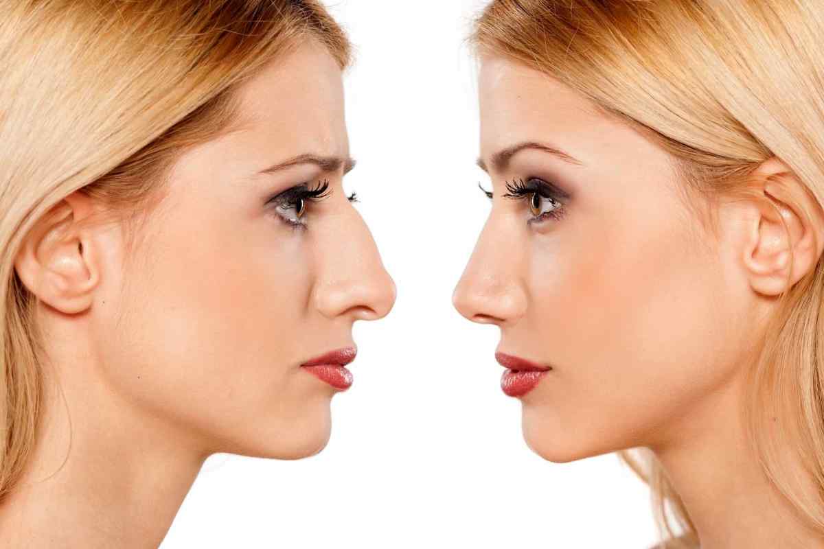 Як визначити характер людини за формою носа