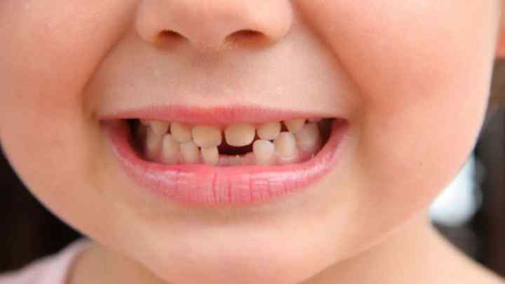 До якого віку у дітей змінюються молочні зуби