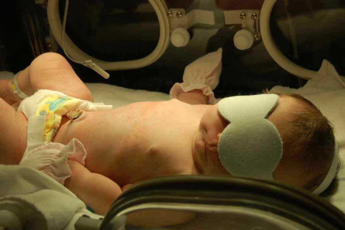 Підвищений білірубін у новонароджених: причини та лікування