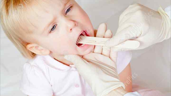Як лікувати горло у дитини народними засобами