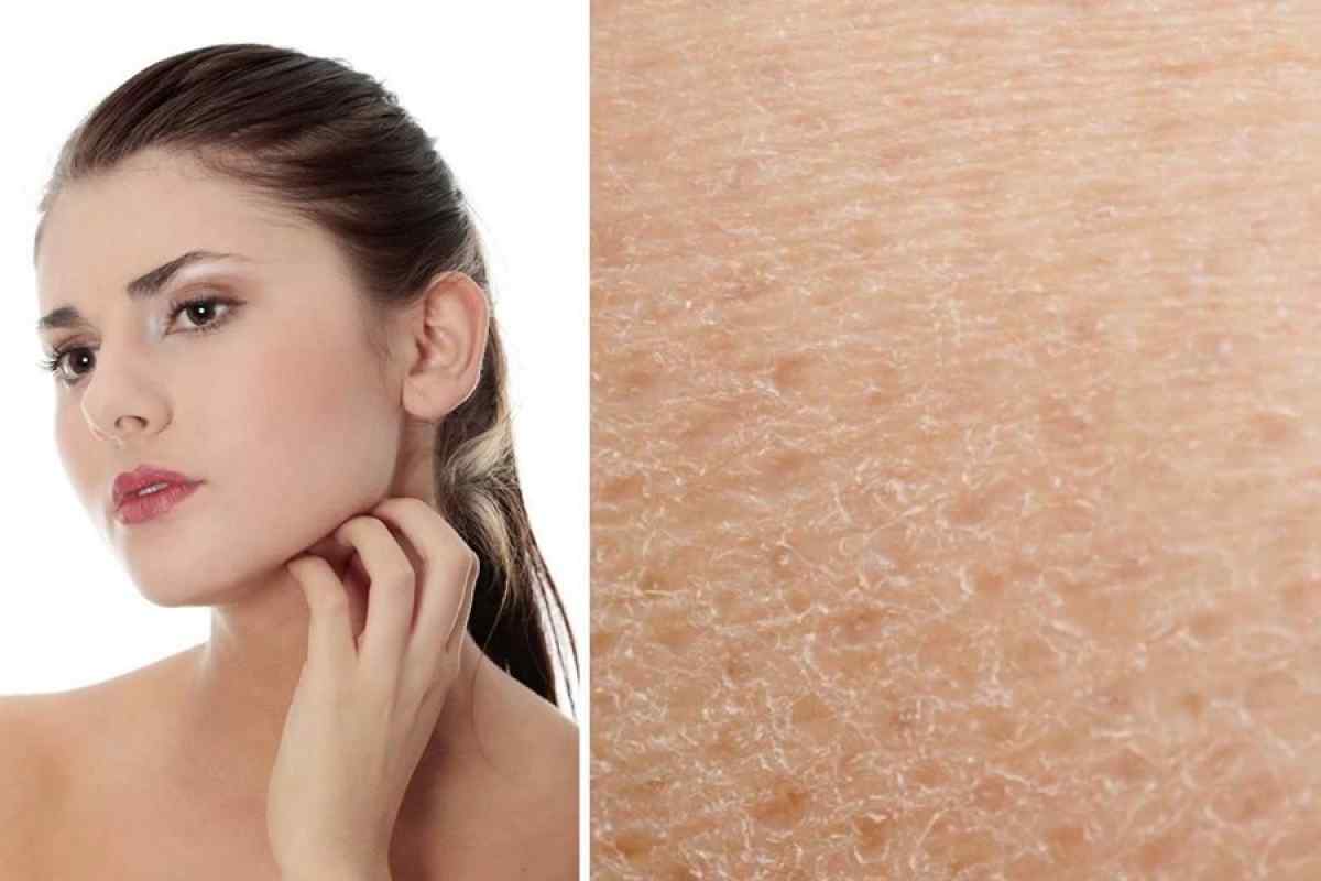 Як підвищити тонус шкіри