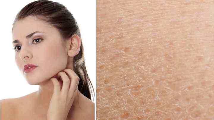 Як підвищити тонус шкіри