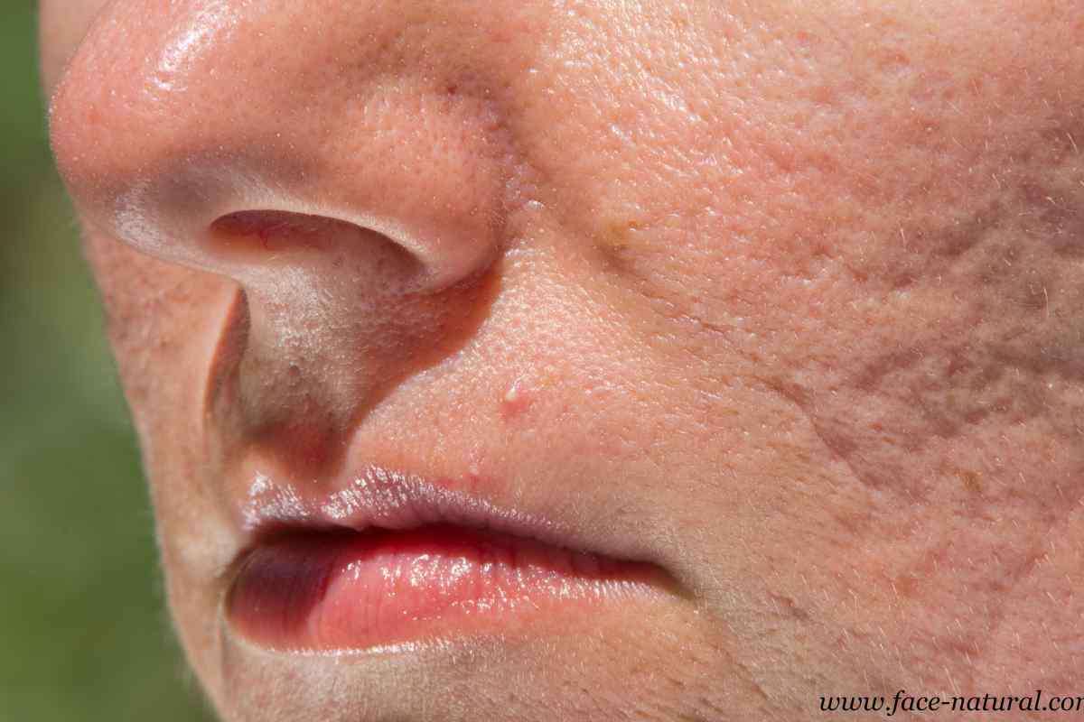Як прибрати шрам на обличчі