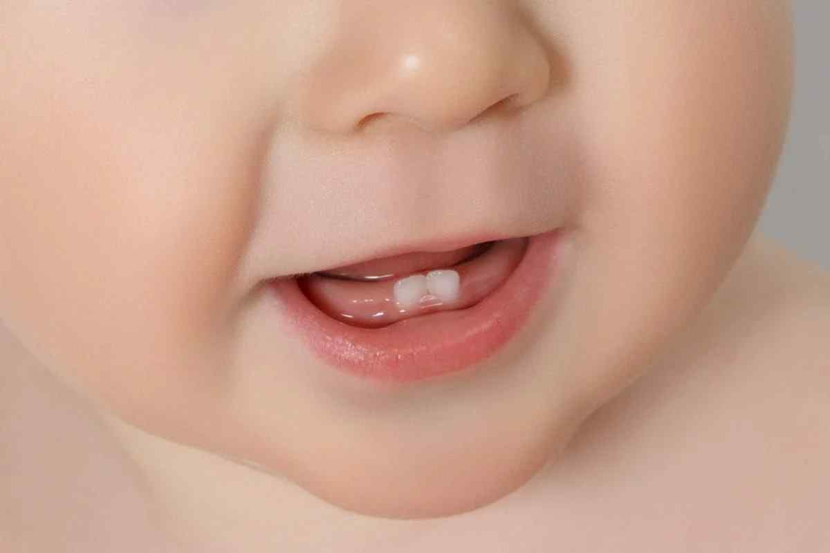 Як визначити, що у дитини ріжеться зуб