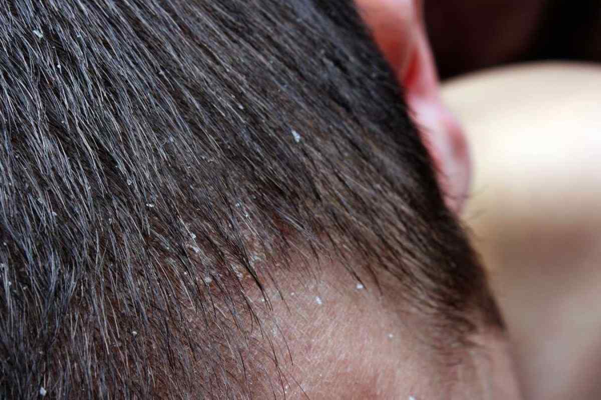 Почему голова после наращивания волос чешется голова