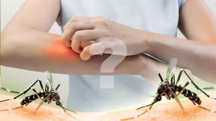 Чому укус комара чешеться
