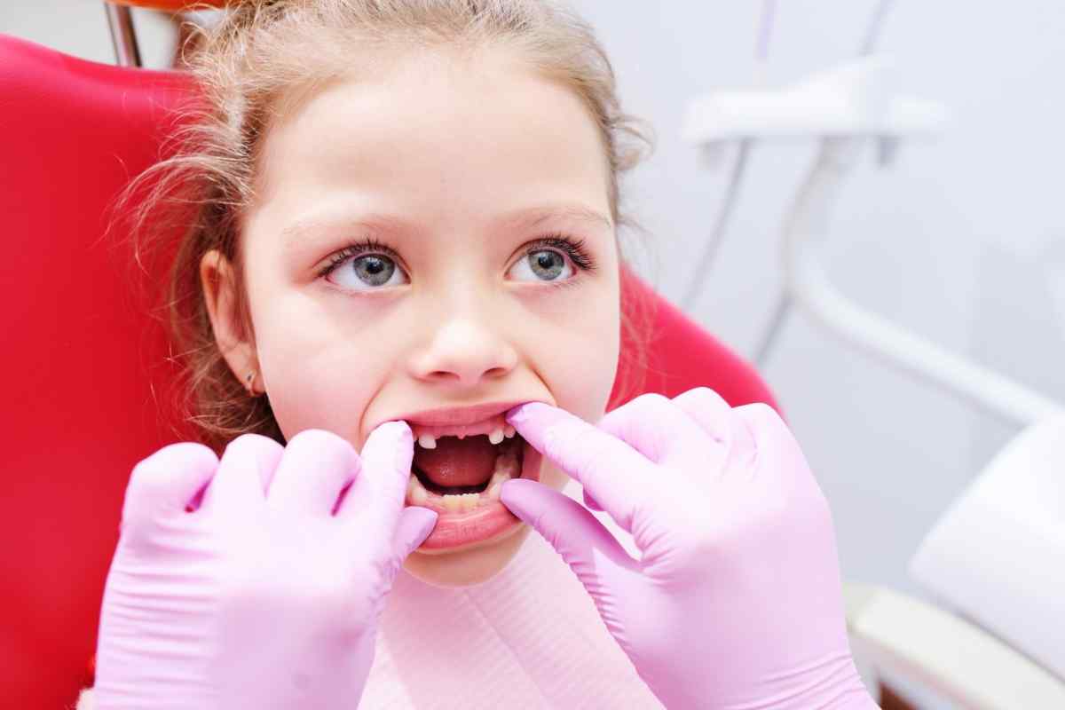 Чи потрібно лікувати молочні зуби дитині до 5 років