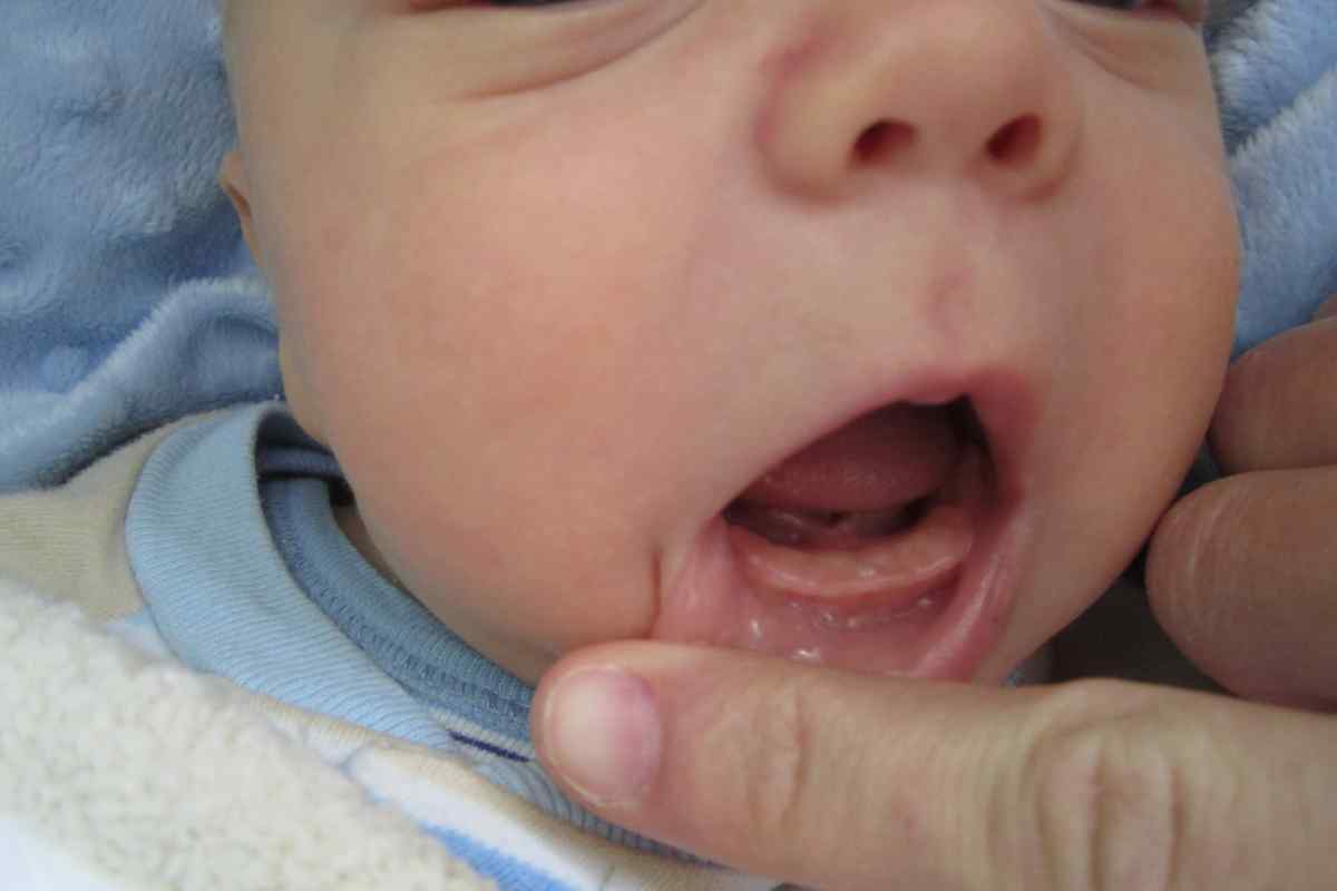 Скільки тримається температура при прорізуванні зубів у дітей