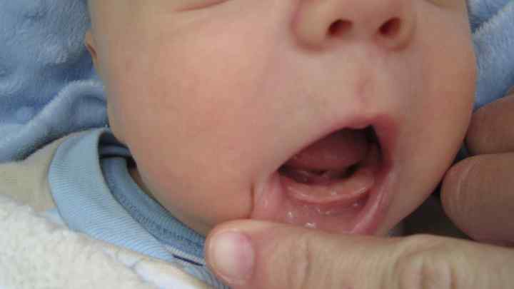 Що робити, якщо у дитини ріжуться зубки