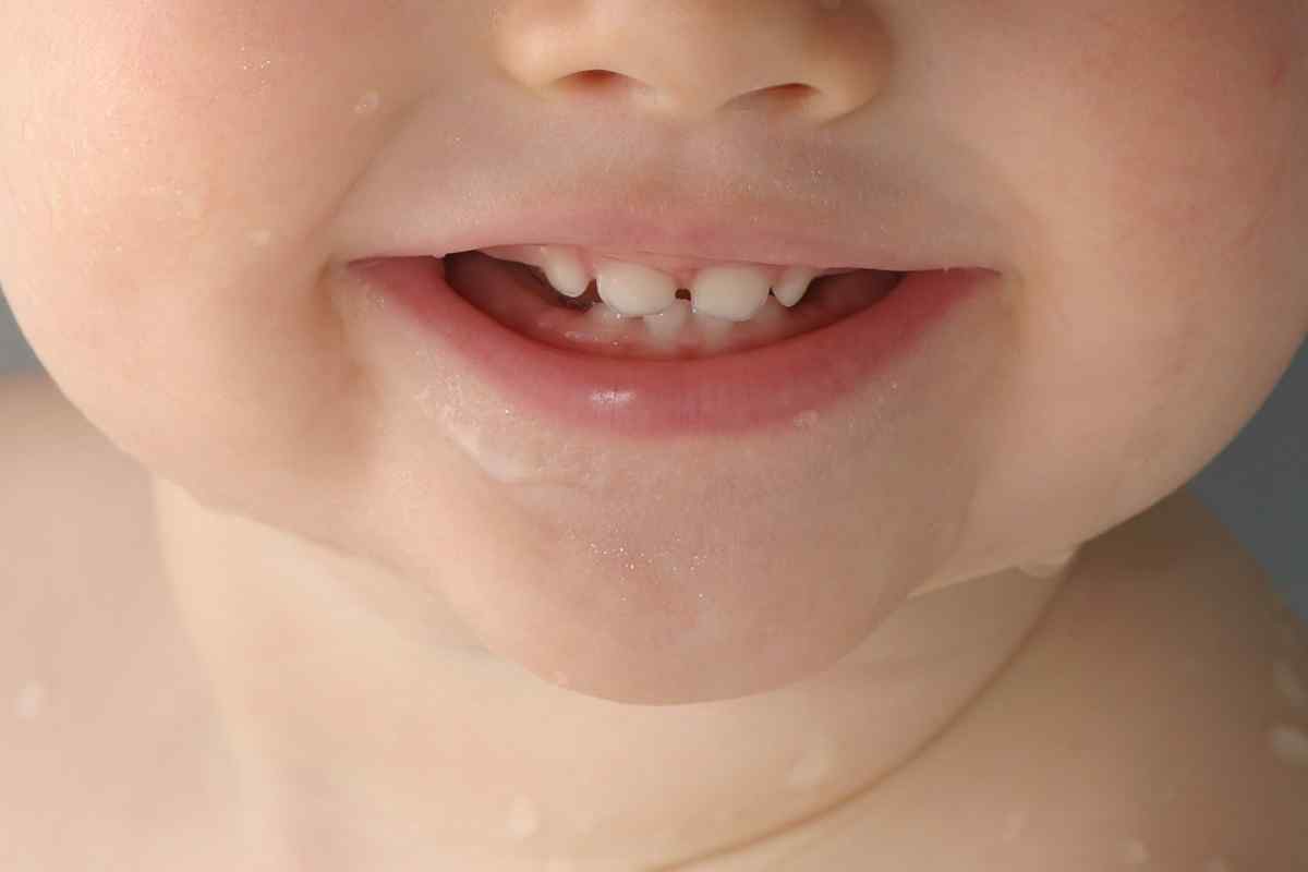 Причина появи білих плям на зубах дитини