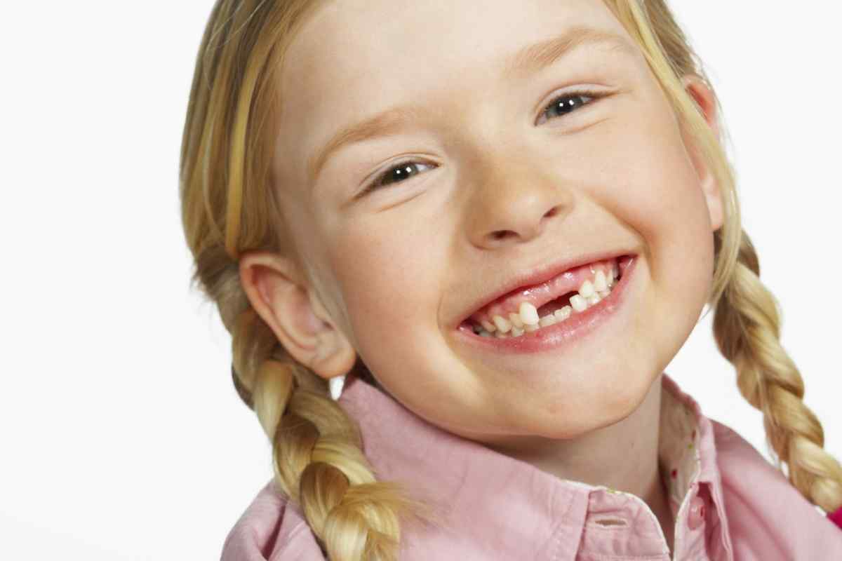 В якому віці випадають молочні зуби