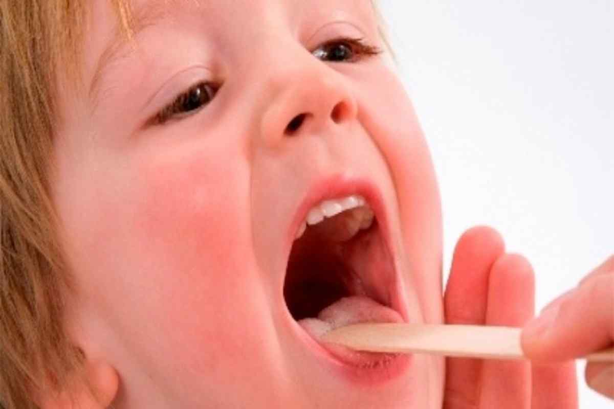 Чому дитина має запах з рота