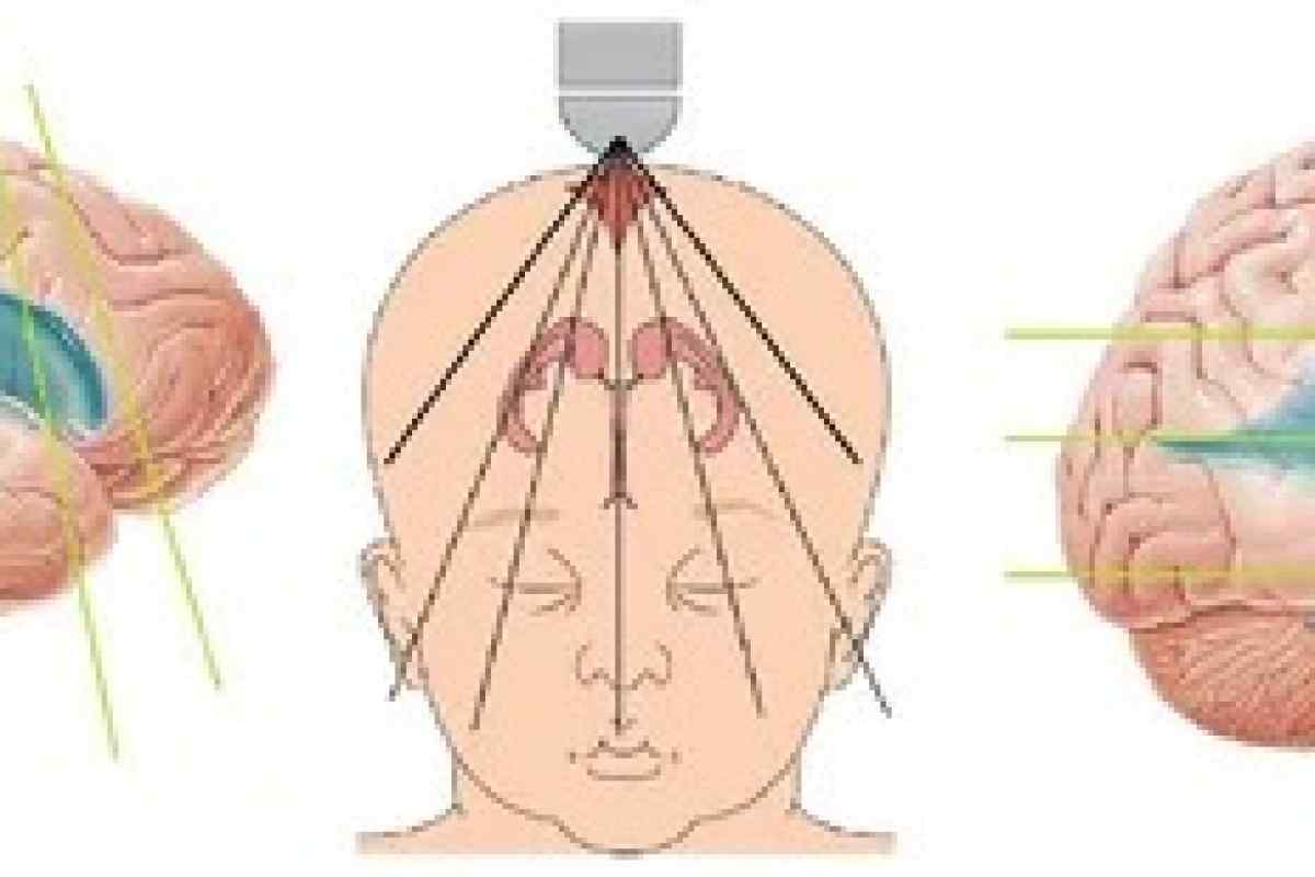 Як підготувати дитину до вузу головного мозку