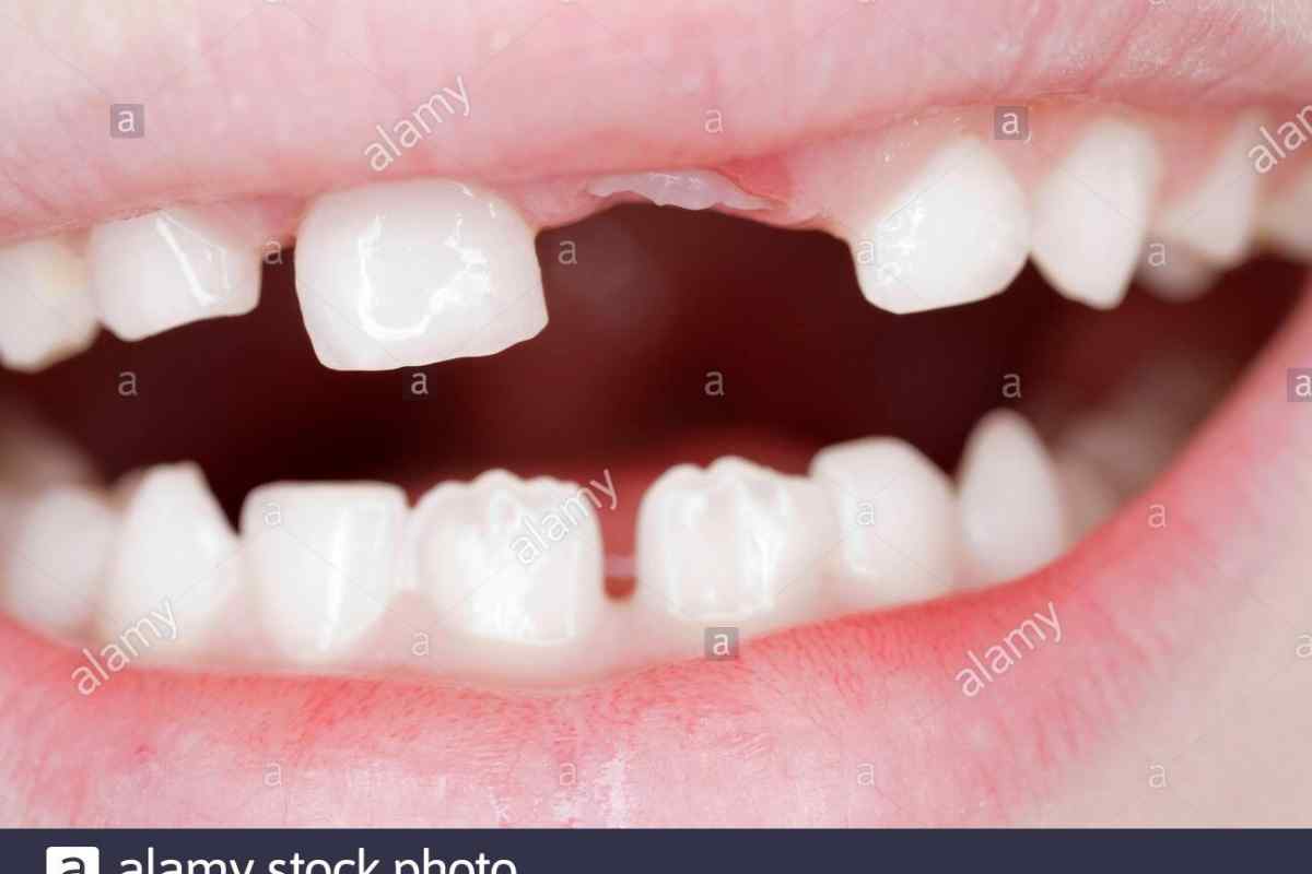 Як і коли ростуть зуби