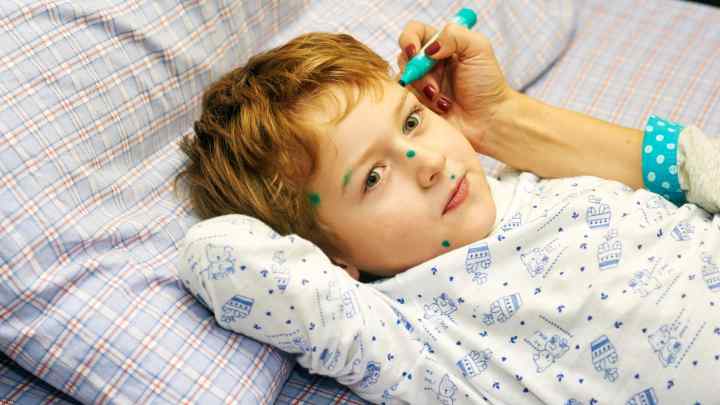 Хвороба Кавасакі у дітей: симптоми, причини, лікування