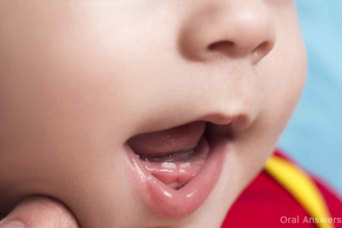 Прорізування зубів у дітей: що робити