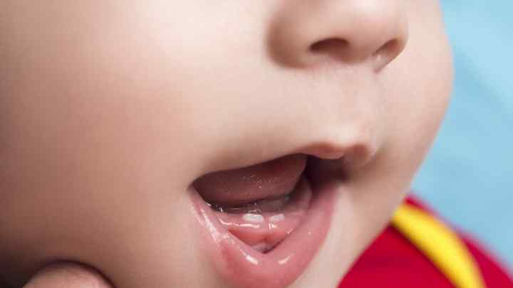 Прорізування зубів у дітей: що робити