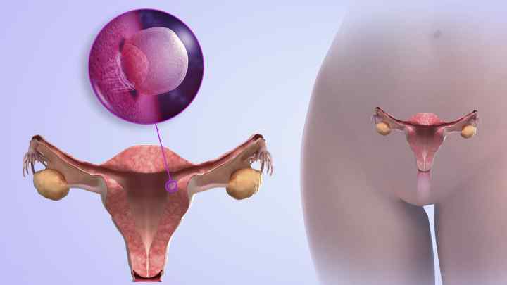 Стимуляція яєчників для планування вагітності: наслідки, відгуки