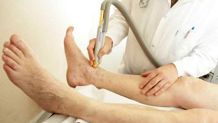 Застій лімфи в ногах: лікування, профілактика та симптоми