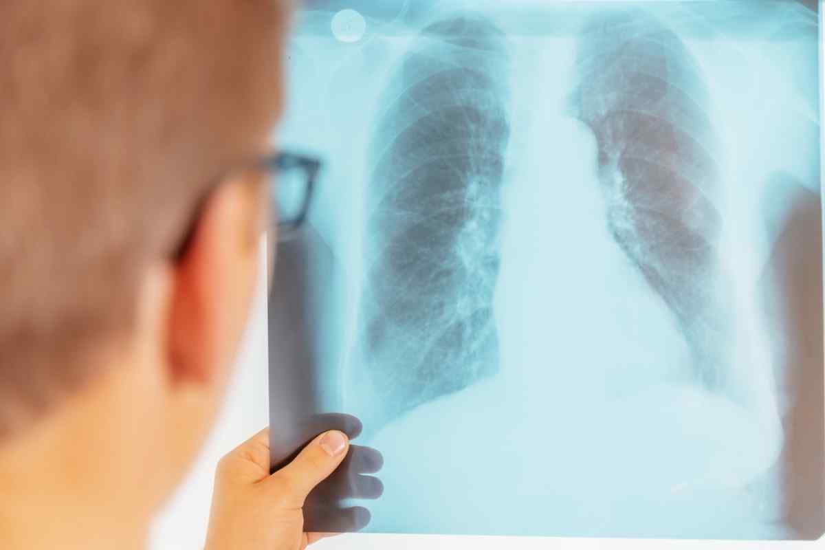 Чому з 'являється туберкульоз: причини захворювання та особливості лікування