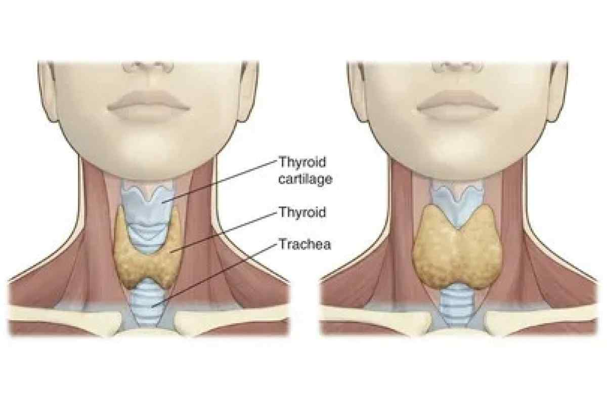 Щитовидный хрящ и щитовидка