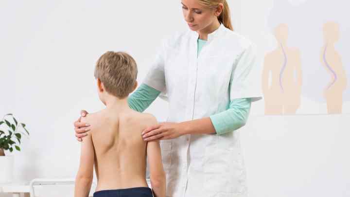 Профілактика сколіозу у дітей: поради медиків