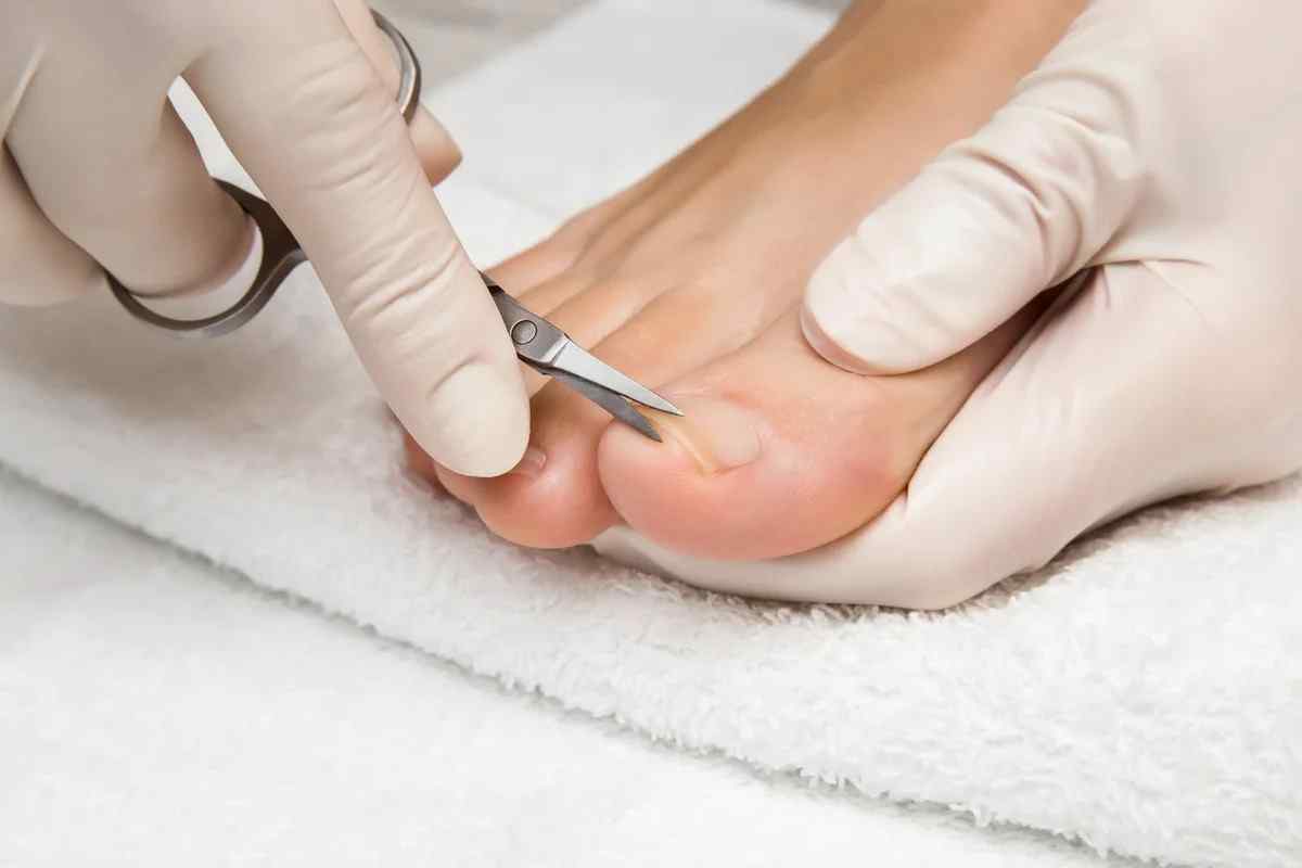 Гній на пальці ноги біля нігтя: причини, способи лікування