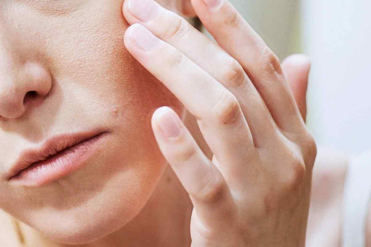 Чому чешеться обличчя: причини та лікування