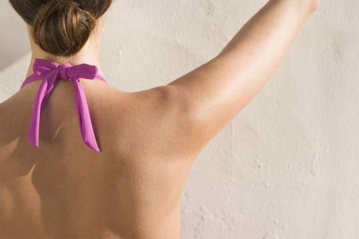 Прищі на плечах: причини. Як лікувати прищі на спині і плечах?