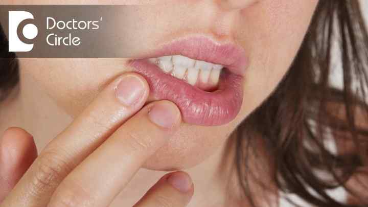 Заїди на губах: причини, методи лікування та профілактика
