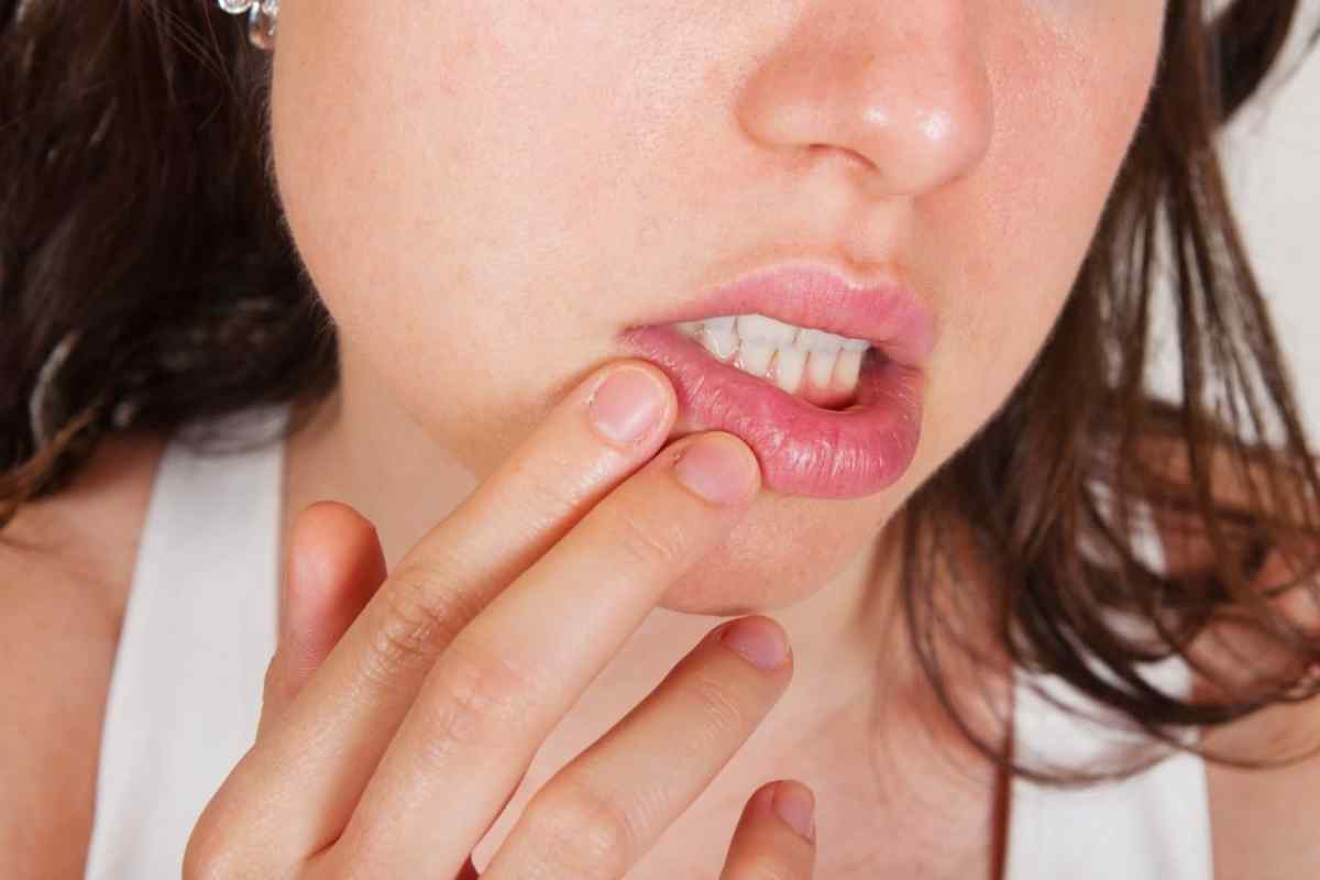 Герпес на губах: причини виникнення, симптоми та лікування