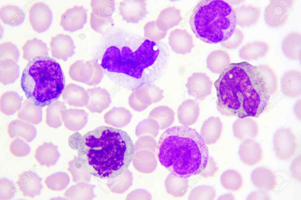 Моноцити: норма в крові жінок і дітей