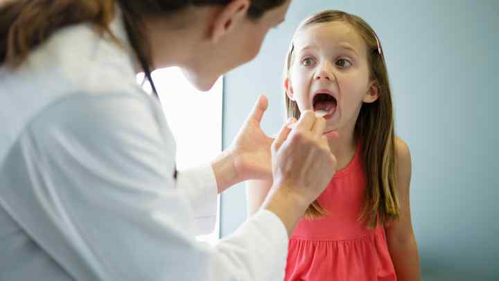 Вірусна ангіна у дітей: симптоми, діагностика та лікування