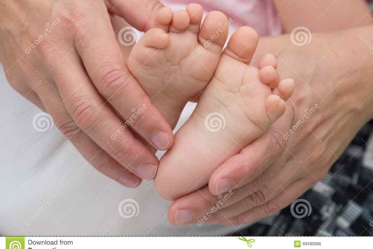 Чому зростаються пальці на нозі? Зрослися пальці на ногах у новонародженого: причини