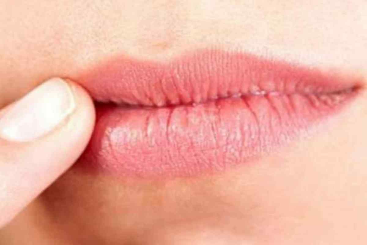 Чому синіють губи у дорослої людини: причини та лікування