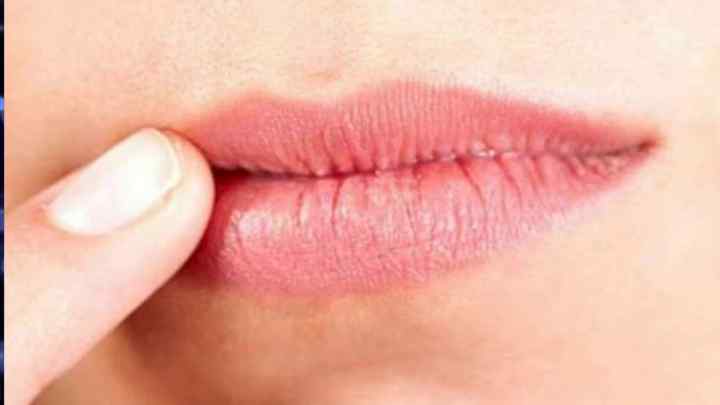 Білі кульки в горлі на гландах з неприємним запахом: причини та способи лікування