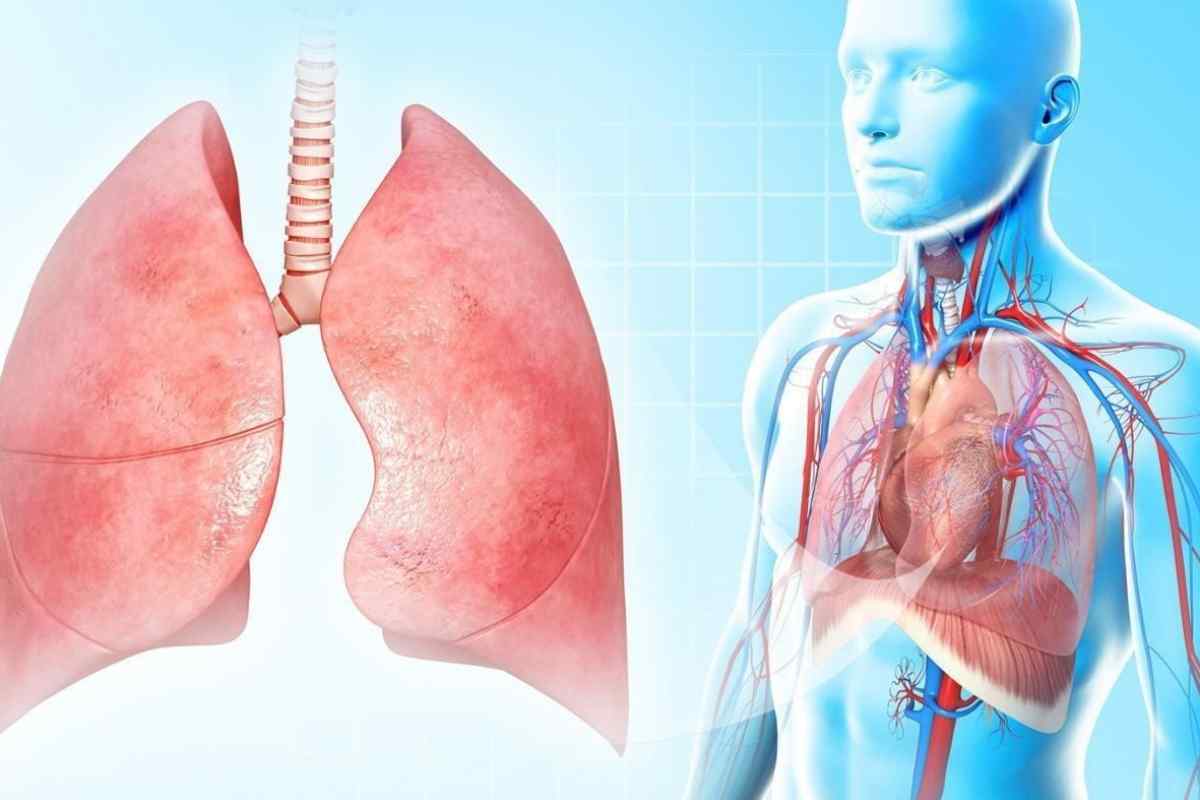 Чи можна ставити гірчичники при запаленні легенів? Чим лікувати запалення легенів