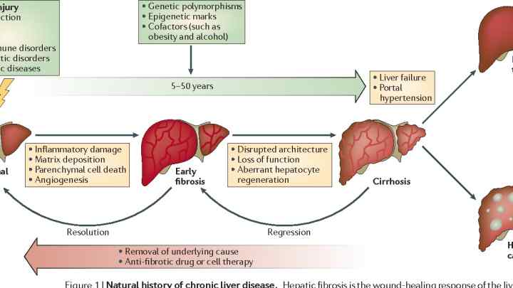 Синдром печінково-клітинної недостатності (мала печінкова недостатність): симптоми і діагностика