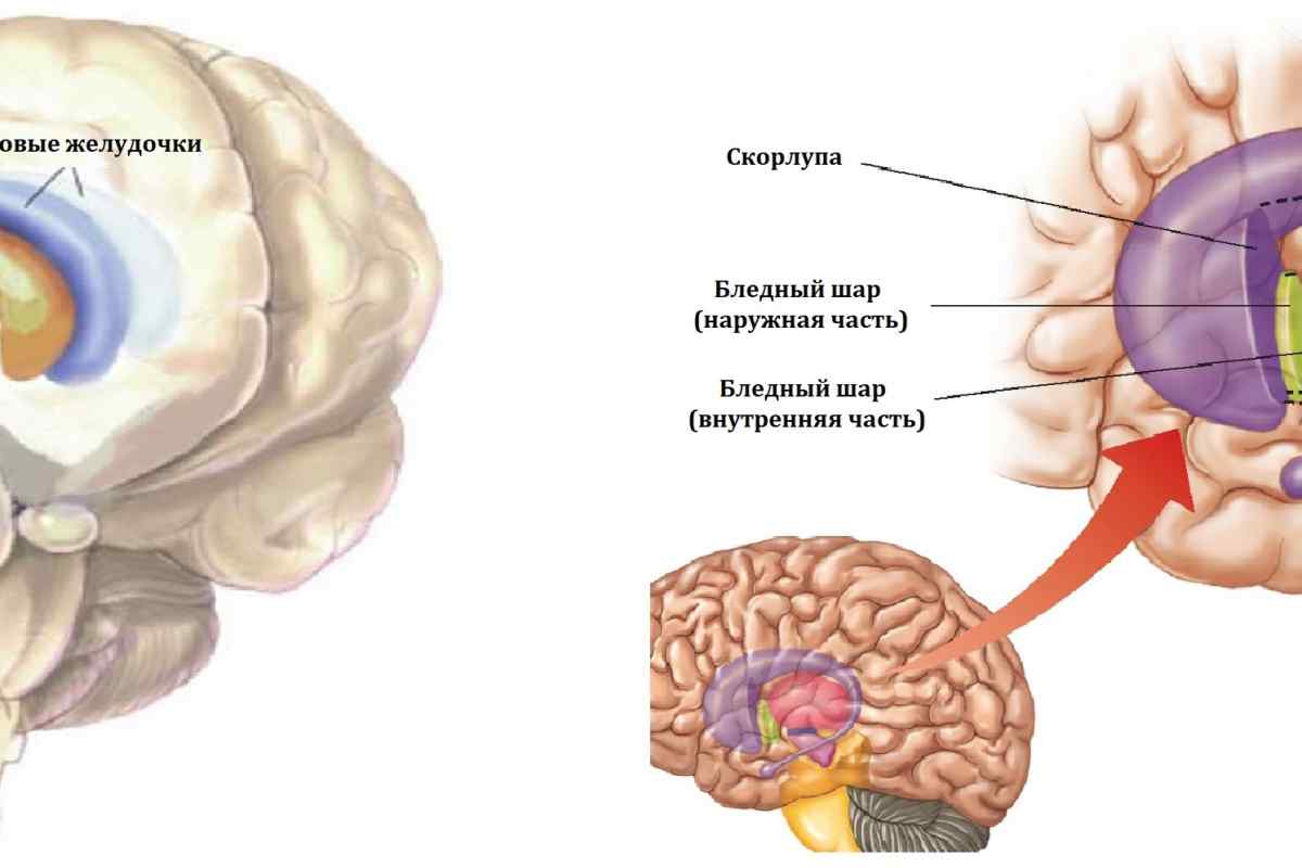 Шлуночки головного мозку